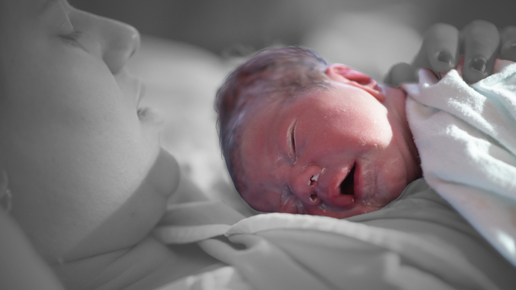 Cenas de filme raramente mostram o vernix caseoso, uma substância esbranquiçada que cobre o corpo do bebê no nascimento - Getty Images/BBC Mundo - Getty Images/BBC Mundo