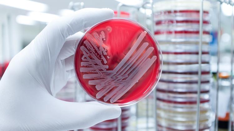 Superbacterias analisadas em laboratório